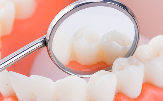 「关注热点」南京种植牙医院较好的排名“排行榜”iti种植牙能用多久排名总榜发布